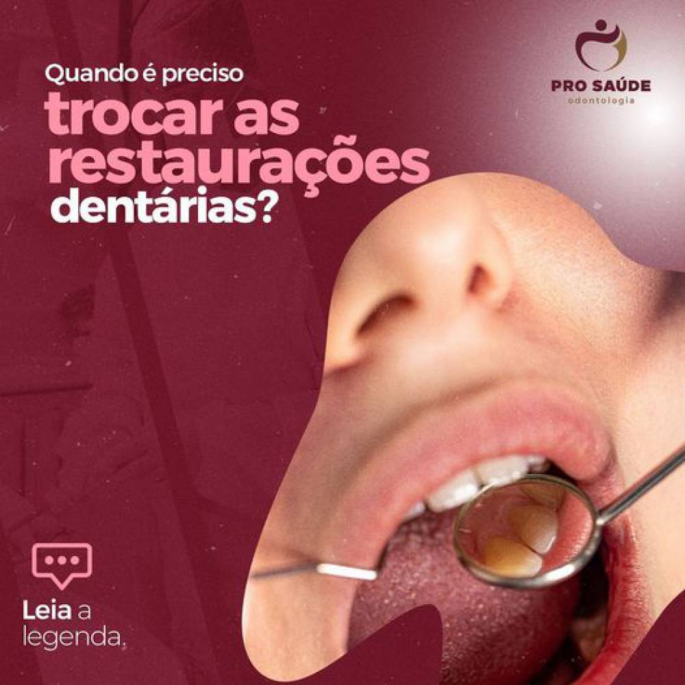 Preciso trocar restaurações dentarias, depois de quanto tempo?